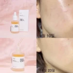آمپول مرطوب‌کننده و تسکین‌دهنده آنوا 80% HeartLeaf